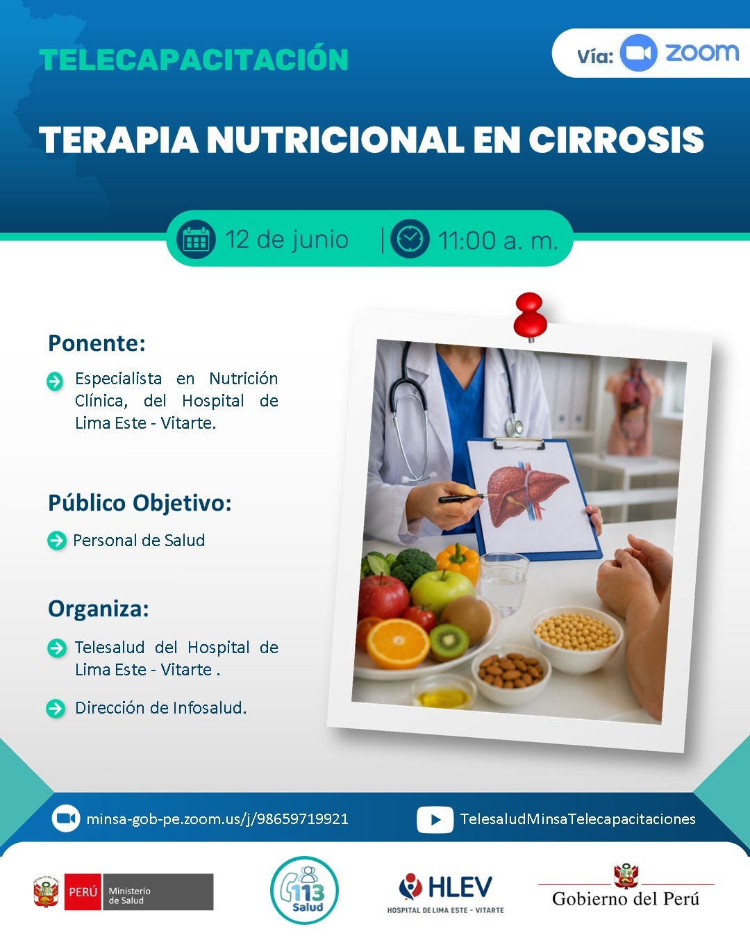 TERAPIA NUTRICIONAL EN CIRROSIS
